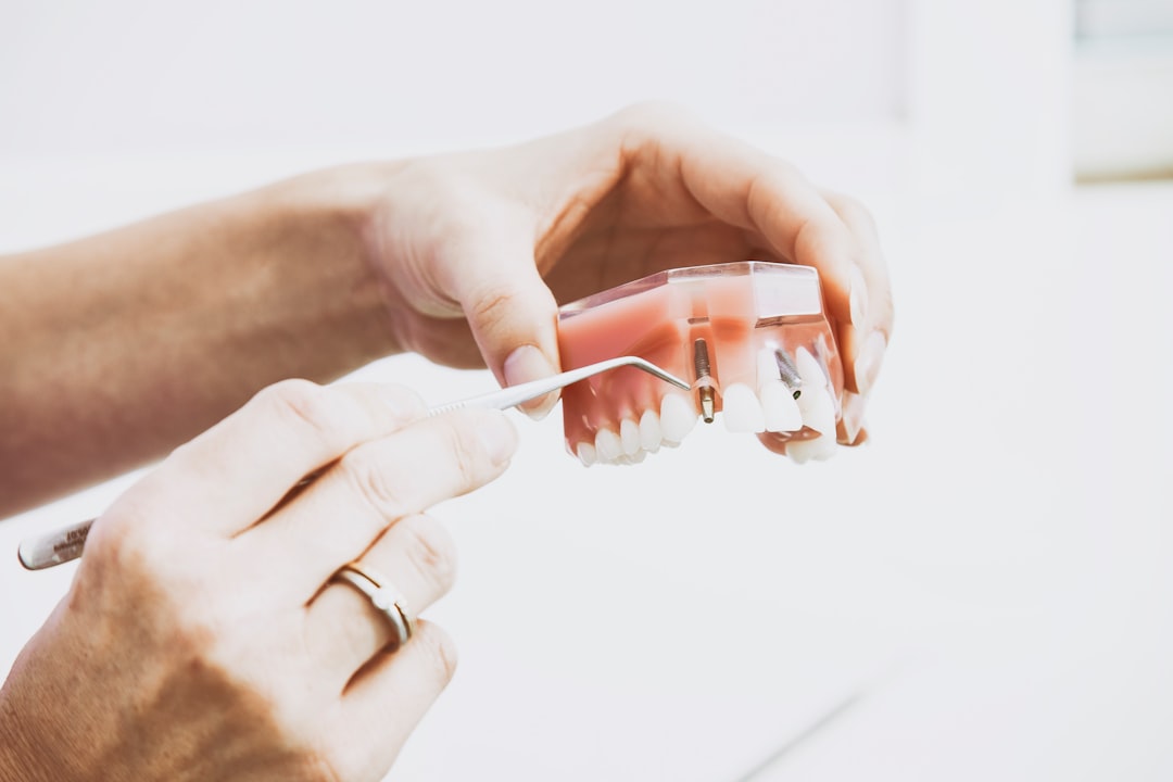 Photo dental implant